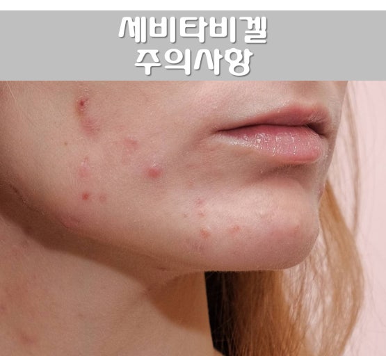 SevitaB Gel 18g